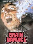 brain1